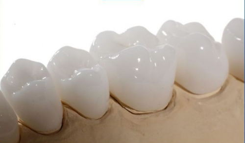 Tìm hiểu về bọc răng sứ Zirconia